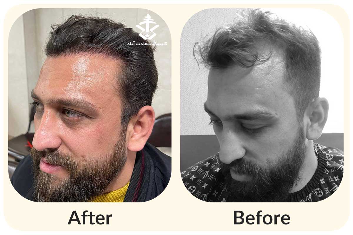 IMG_634FDA-B1EA39-4FC994-0F8F9C-3C5812-7D4523