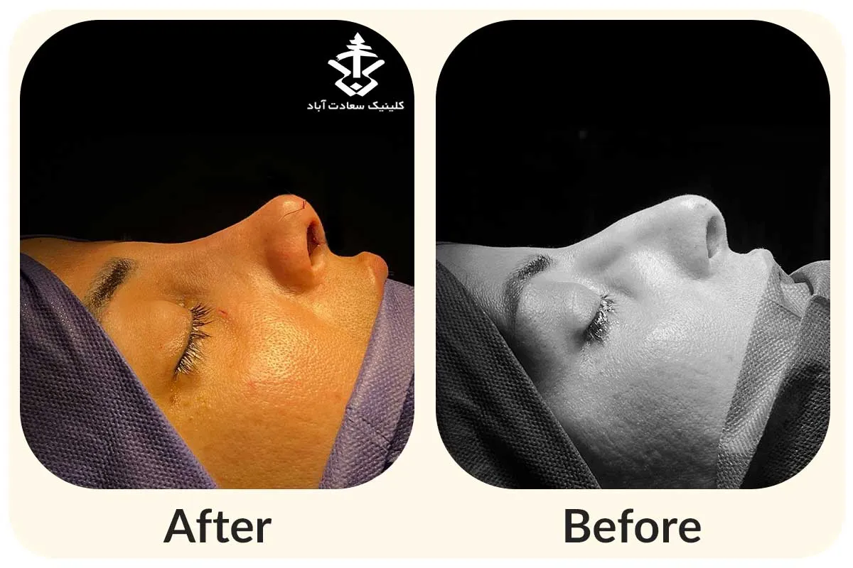 IMG_6474D0-89600E-06DB0F-EBF51D-5E1069-FA4692