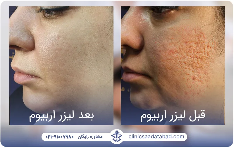 IMG_6677F7-CFFEAD-0349F7-182EF8-9A80C9-3CAB93