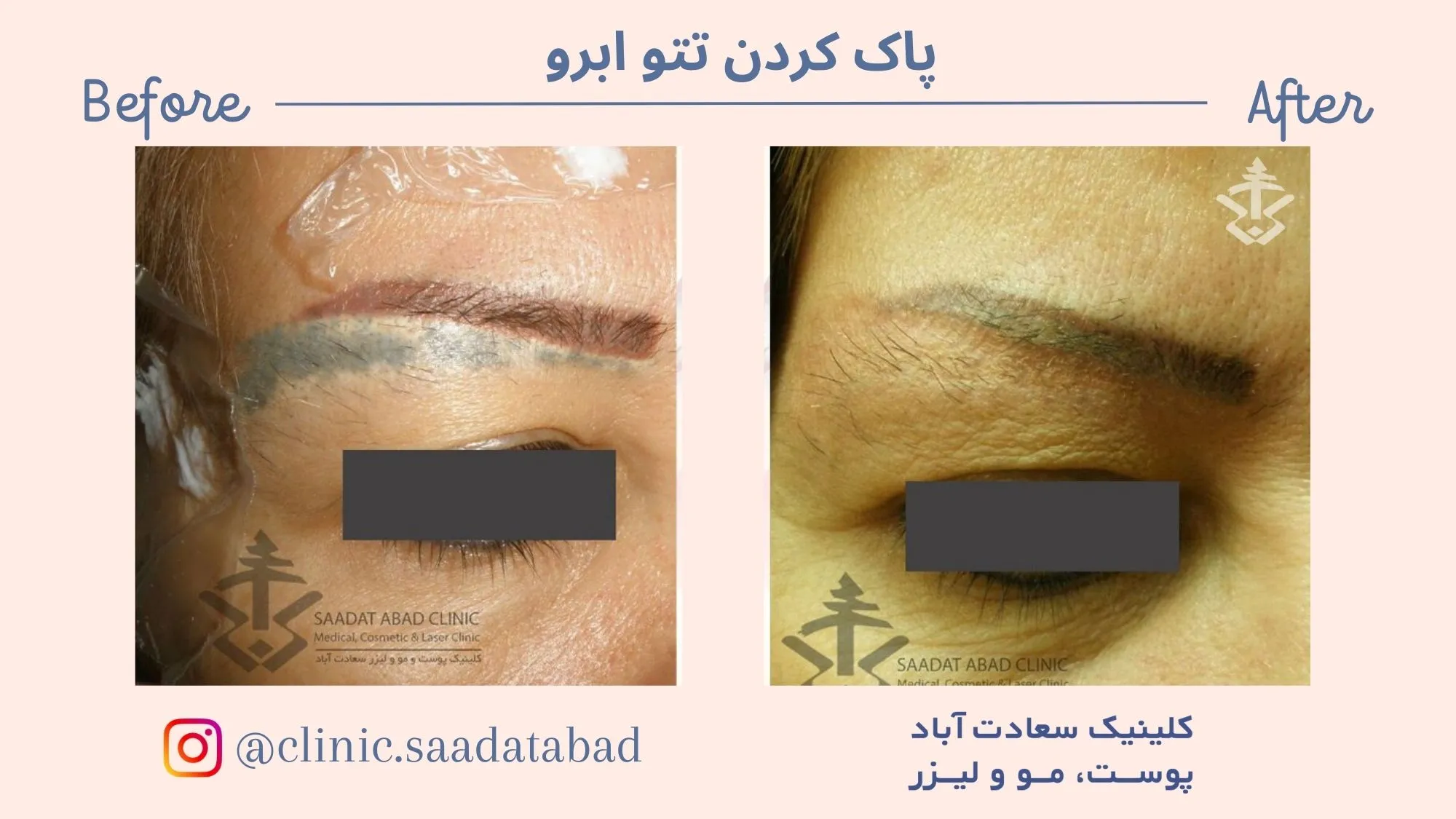 IMG_7B4BF7-878AE7-309C9F-110DB0-3828C5-FCD61E