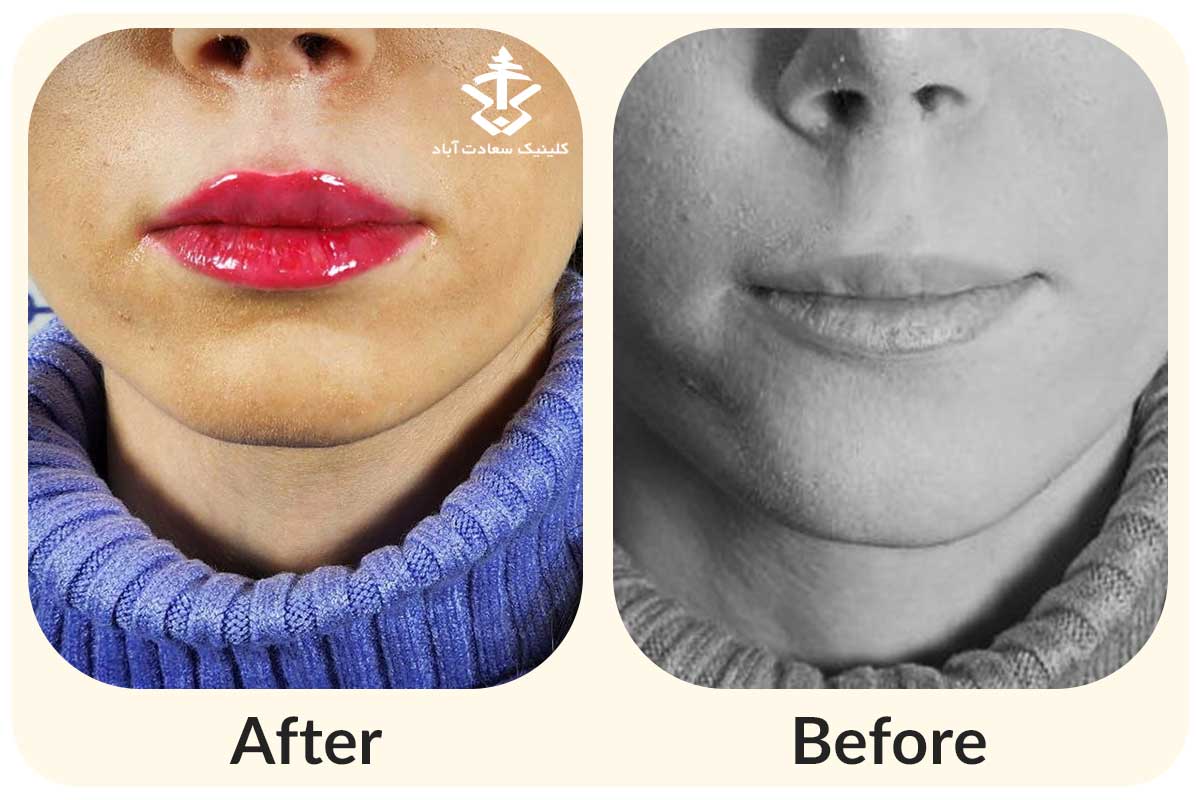 IMG_7F0A22-72924B-B703DB-BFC1E4-591E7F-CF8886