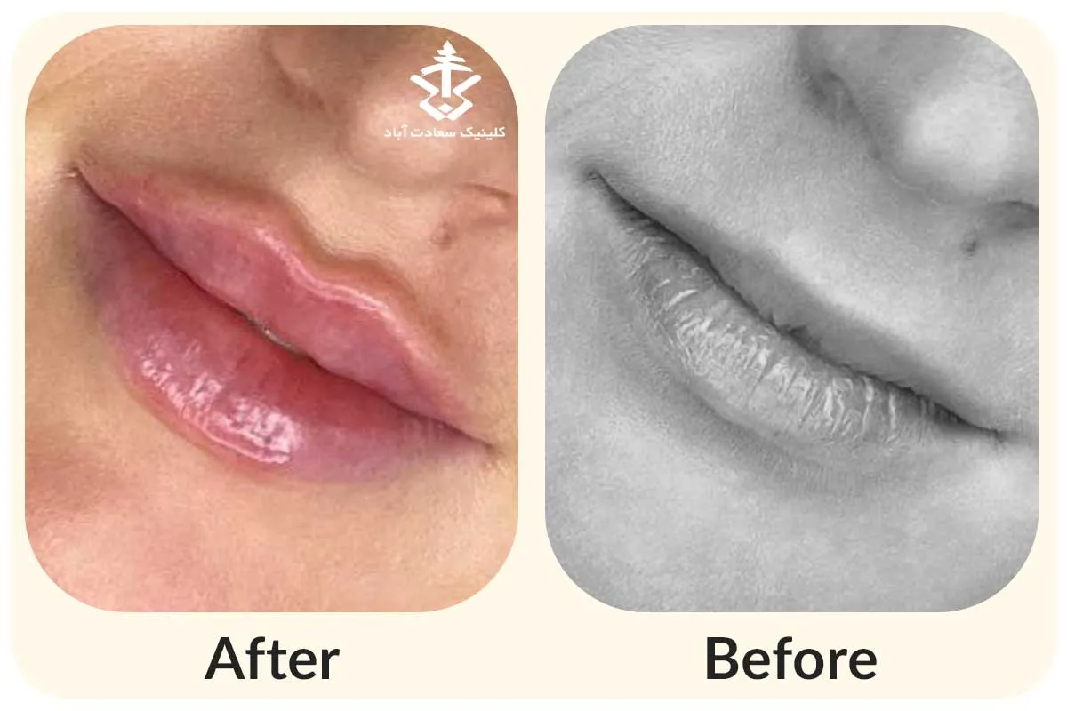 IMG_8E67ED-7C74F6-A4A502-15C03B-576255-C10E89