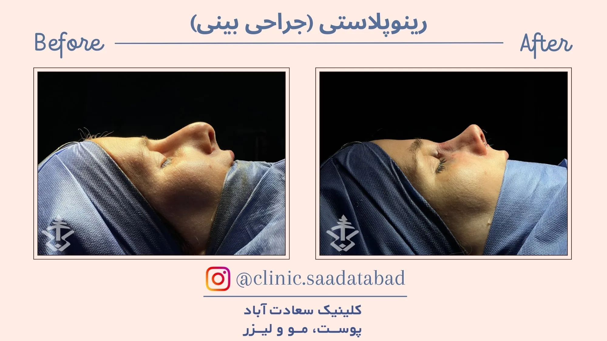 IMG_9153E3-183865-147ED3-EA0510-1C1F9D-470458