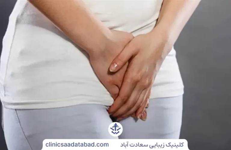 درمان خروج باد از واژن