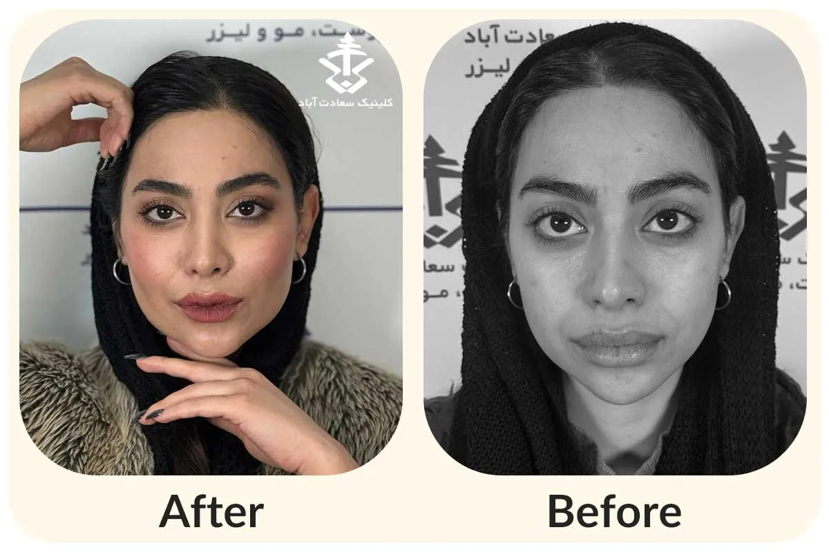 IMG_A5A791-1E3D79-EC4CC0-310142-5D63B9-C79F49