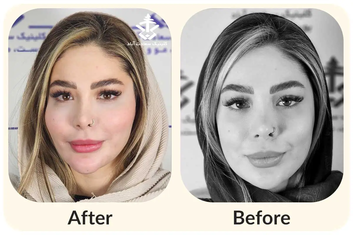 IMG_AB2B18-BC1A9B-97FDB3-CF452A-BF2D9E-C64159