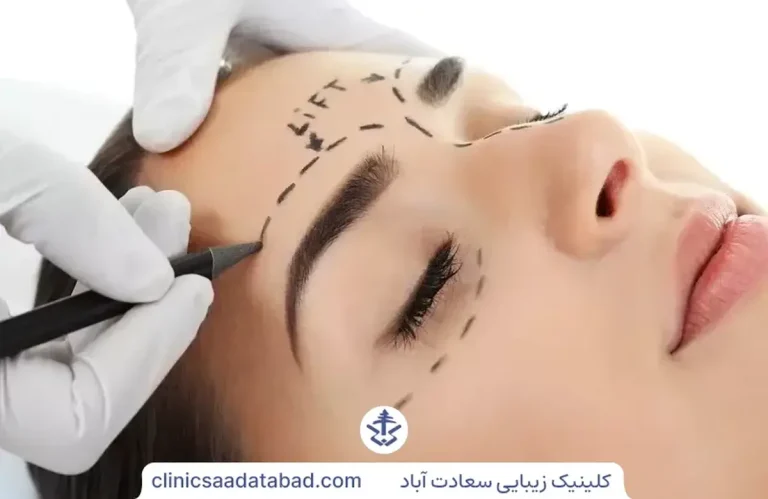 بوتاکس ابرو