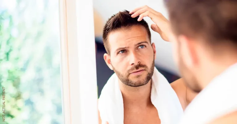 نتیجه نهایی کاشت مو