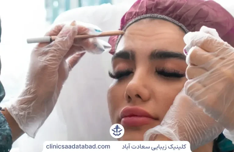 تزریق ژل به پیشانی