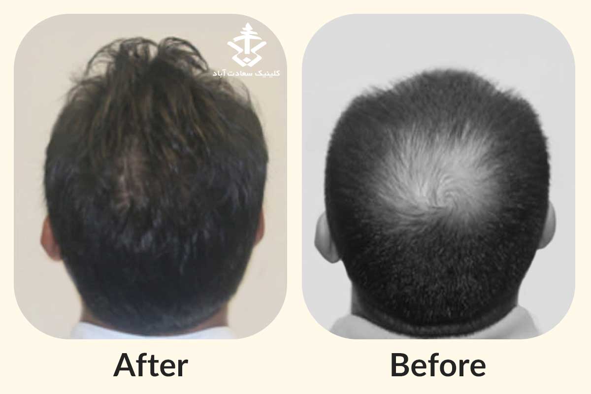 IMG_C11A47-509F02-F934B1-0457B0-7A1312-C6D26A