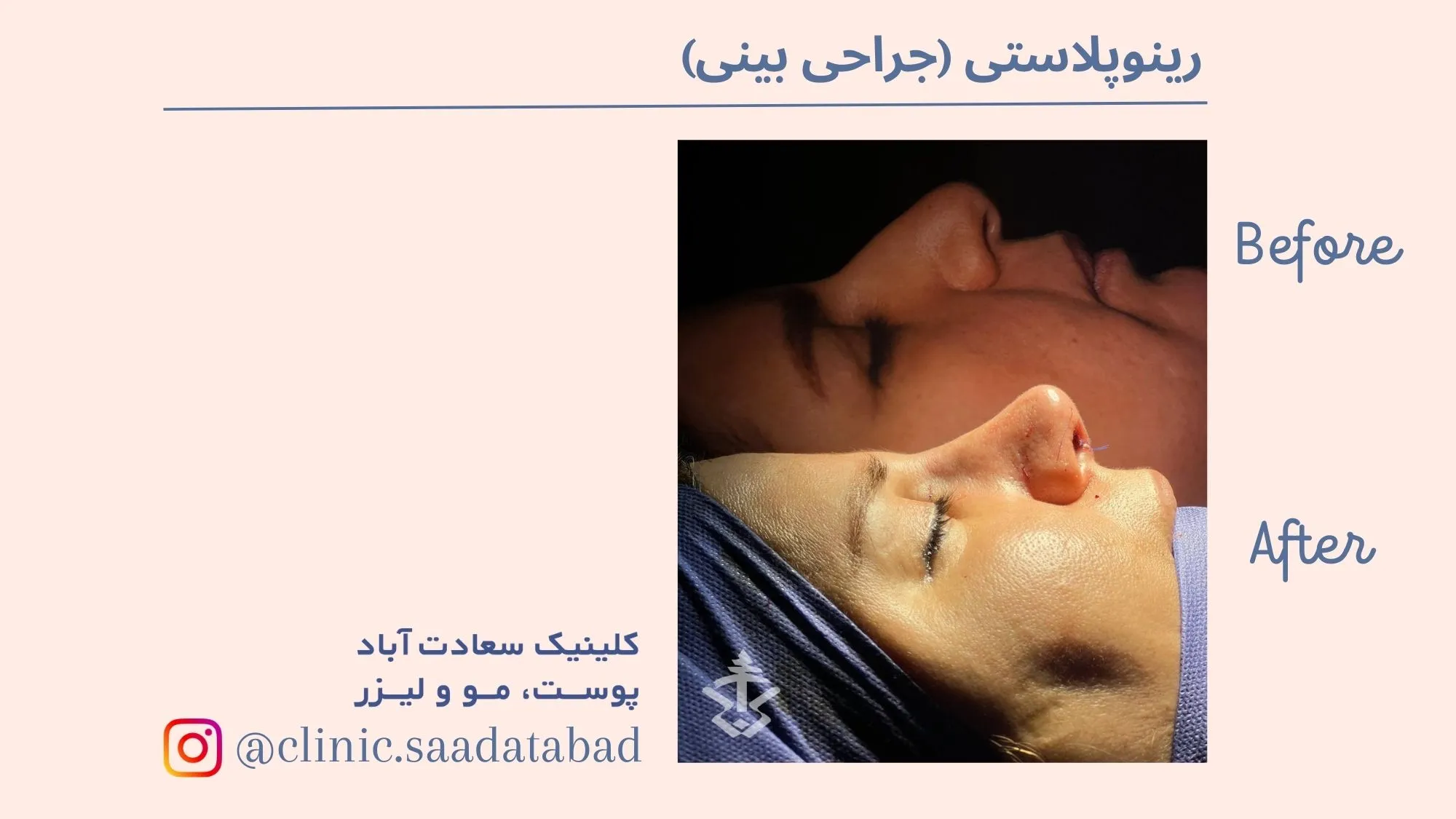 IMG_C12F03-F9AF80-B2042B-328F6B-D63E2F-DEA8EA