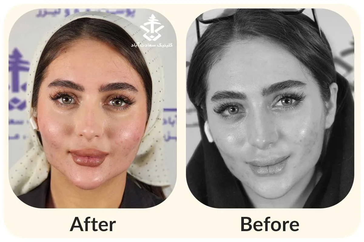 IMG_C82EB8-53EED4-946A1C-EA384C-E1A06A-5E9169