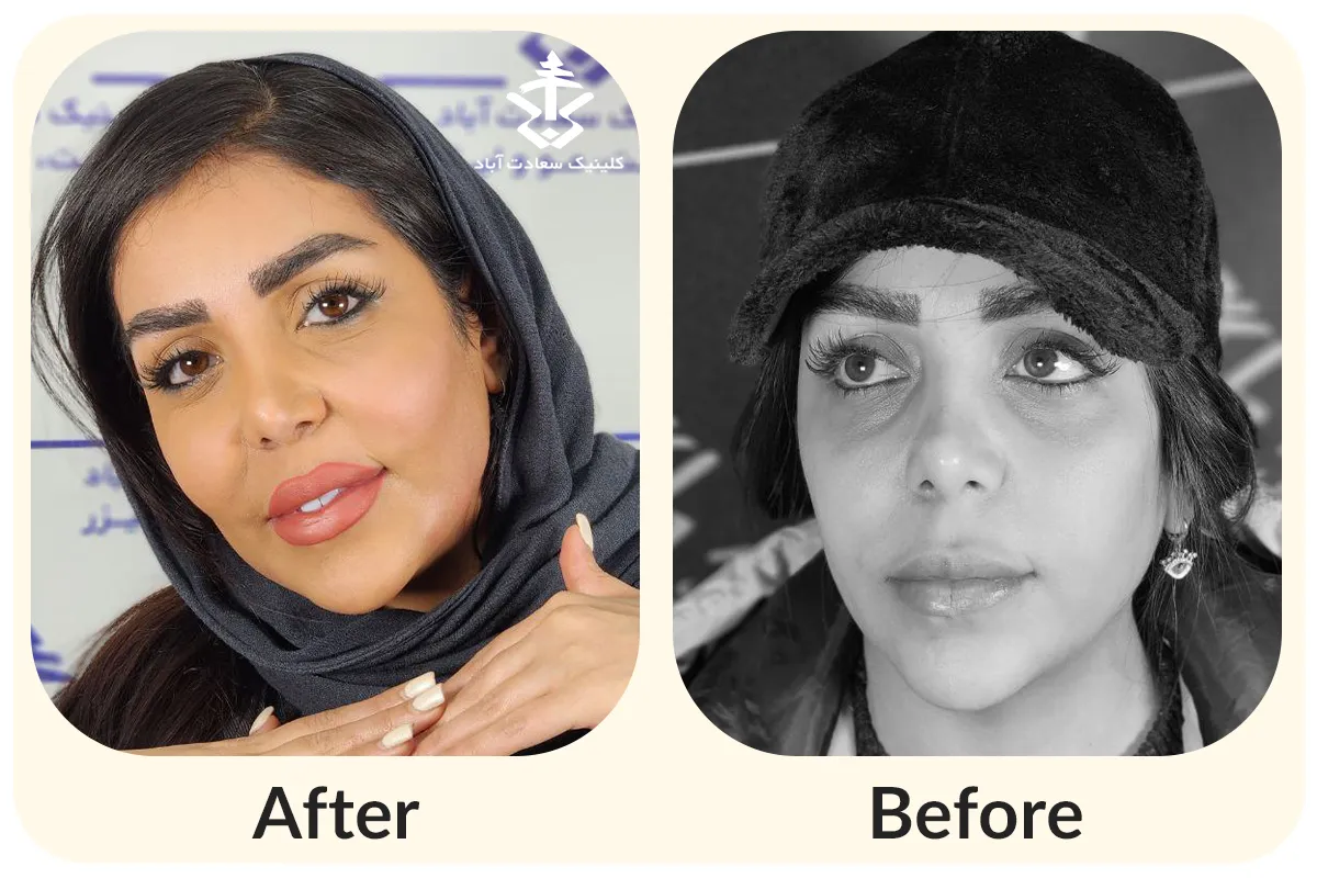 IMG_CDEACB-828951-055B38-BBD2D6-A17D41-64FB87