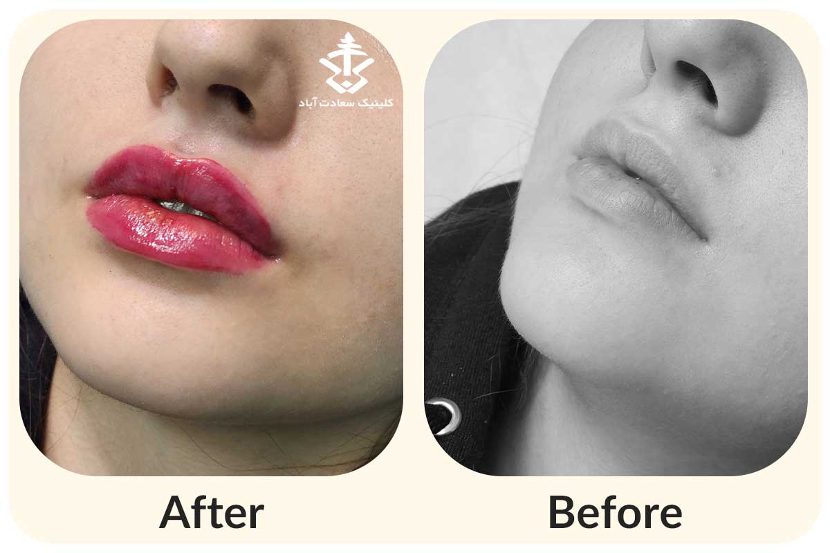 IMG_CE8268-9AF75B-208A54-09ACE4-303FEE-D1519F