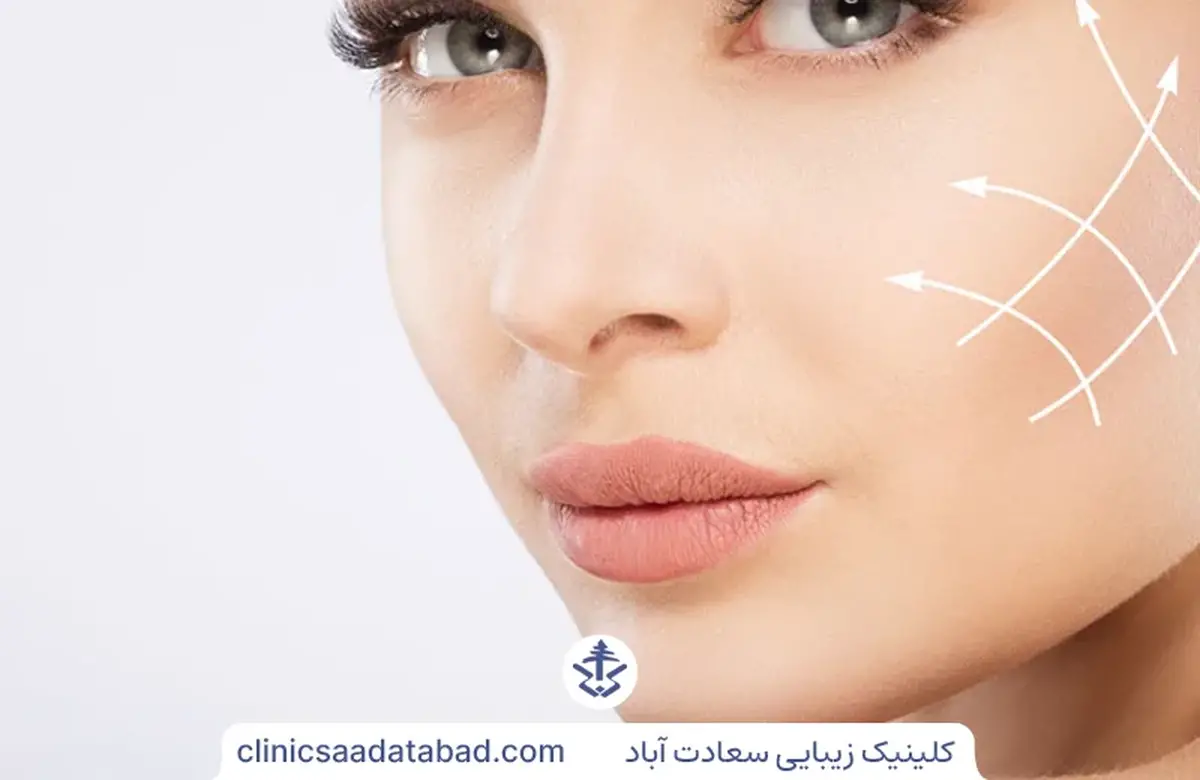 تزریق ژل به گونه
