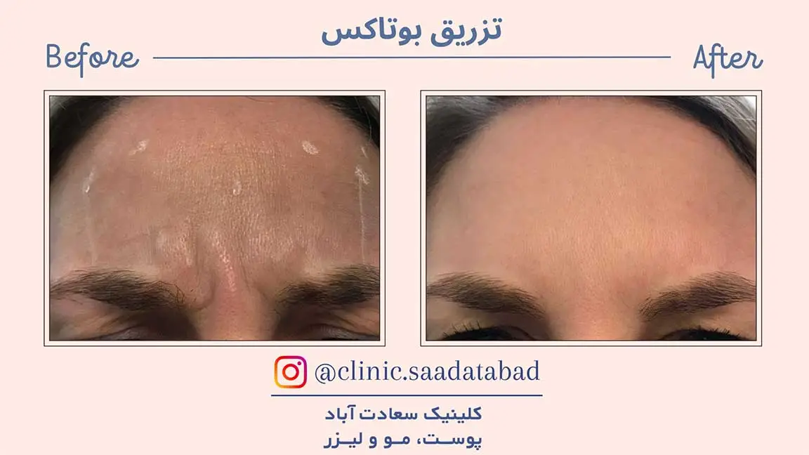 IMG_DE32A2-35FD0F-18ED60-19DE40-C016E4-8ACEC5