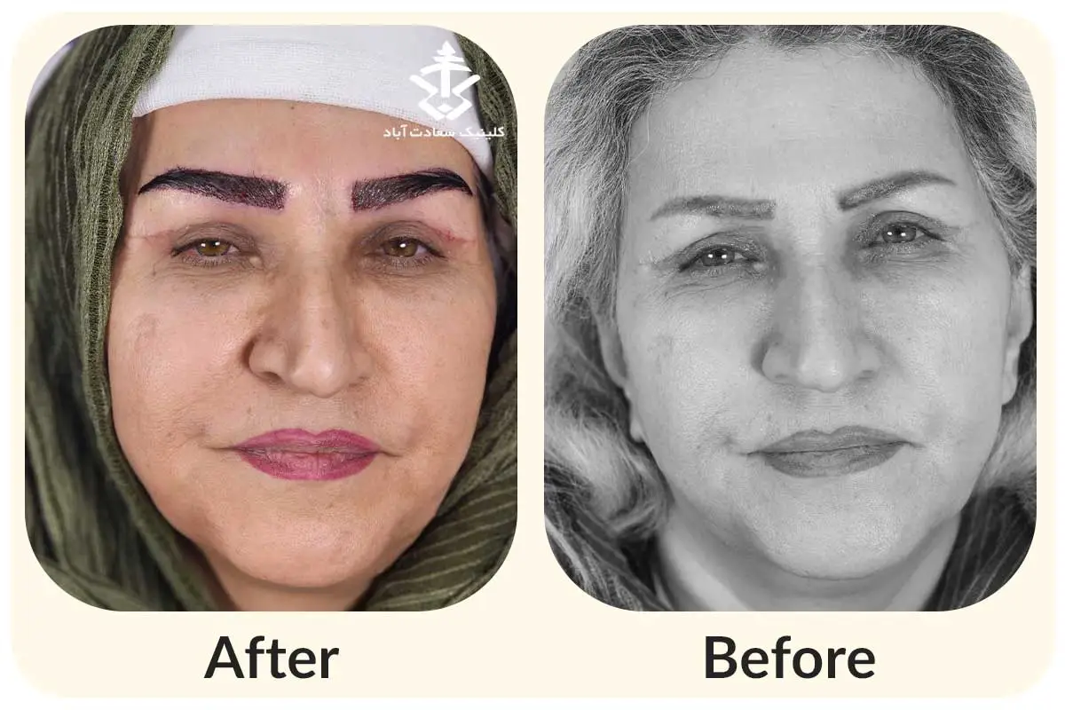 IMG_E65F3C-104522-59E101-F1E27A-6A97FF-64FEDA