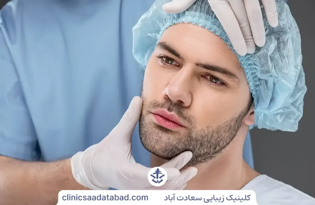 کاشت ریش