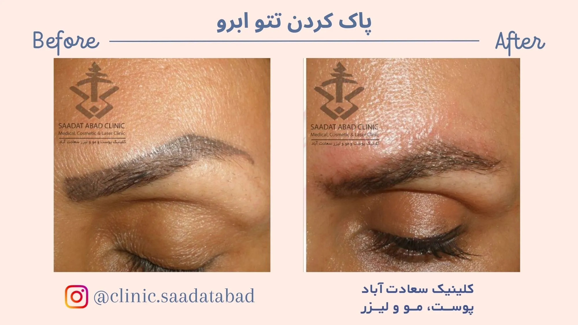 IMG_EB094D-2495C2-B4FB0E-DD0E57-FC7860-768F95