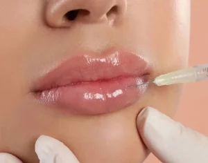 مراقبت های بعداز تزریق ژل لب