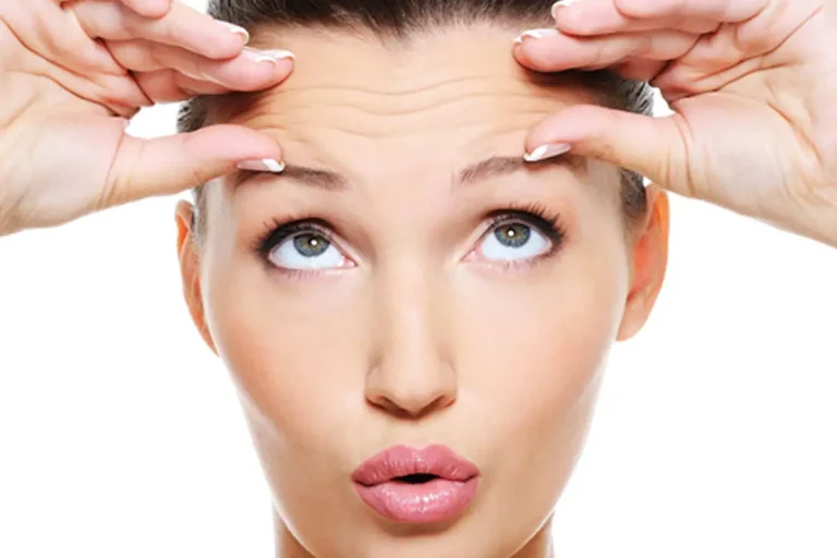 رفع چین و چروک‌های پیشانی