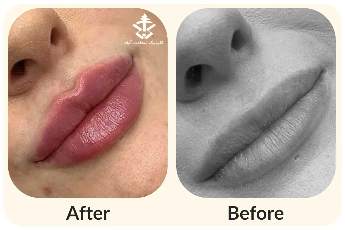 IMG_F60210-A55C0E-5B2B3B-7FD890-6DD75E-D87996