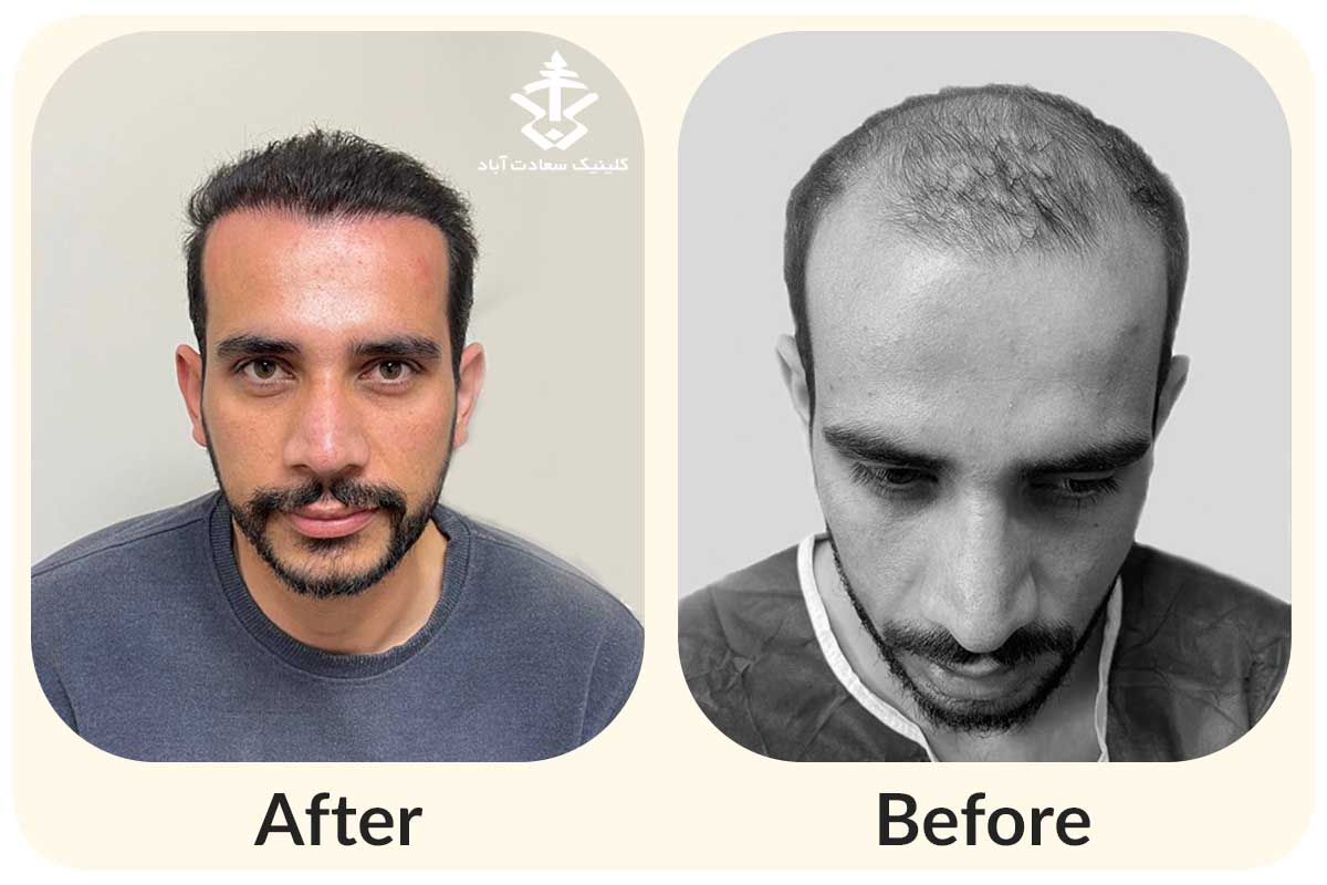 IMG_FDA53A-CE09C8-35CDF0-2AAC1D-F8131E-33F94A