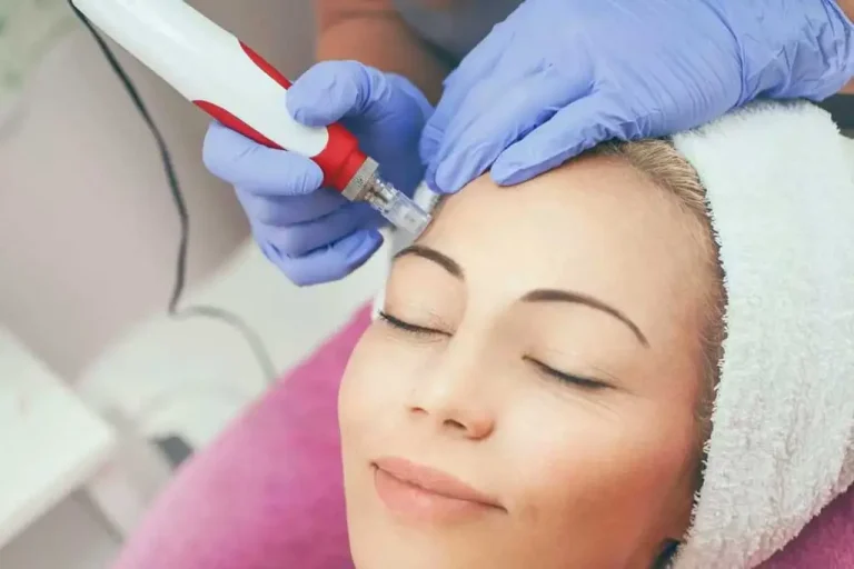 لیزر درمانی لک های پوستی