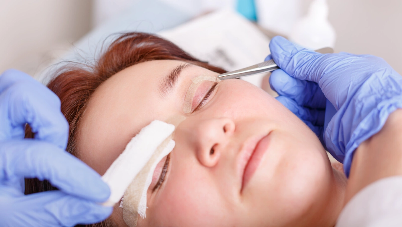 آمادگی و مراقبت قبل از بلفاروپلاستی