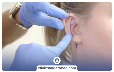 مراقبت بعد از جراحی گوش