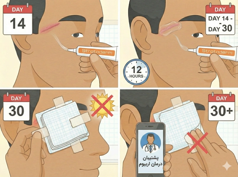 مراقبت روز 14 به بعد لیزر اربیوم