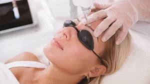 پاک کردن تتوی ابرو