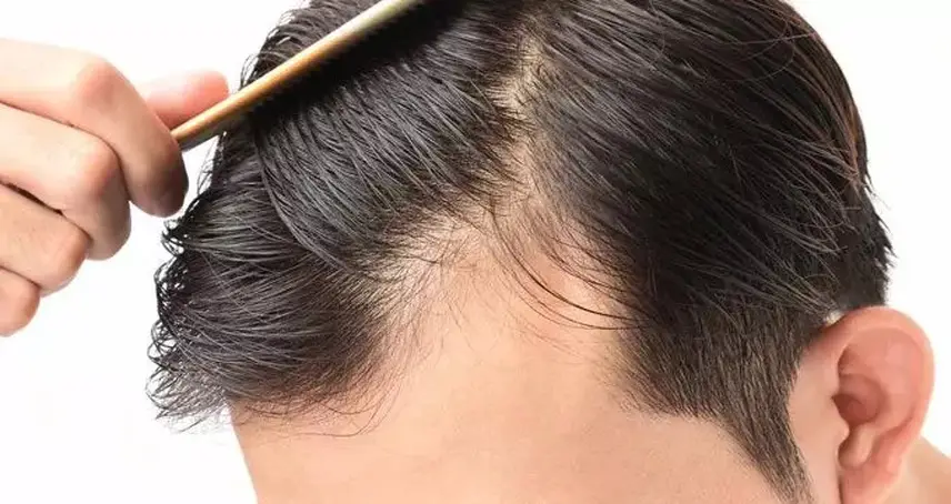 پیشگیری از عفونت بعد از کاشت