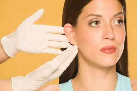 جراحی گوش برچسته