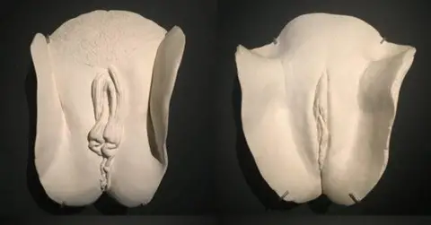 روش‌های جوان‌سازی و لیفت لابیا