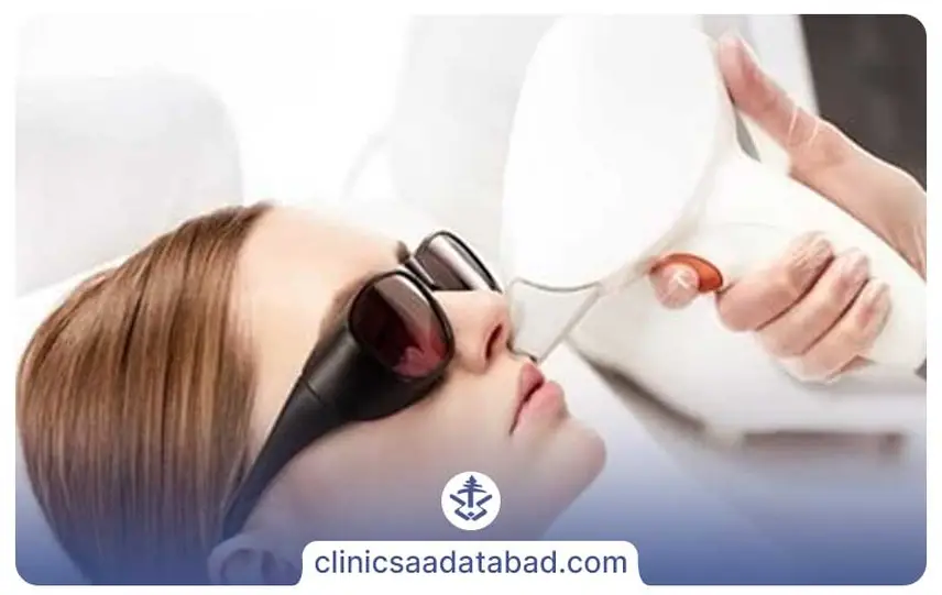 لیزر بدون ژل