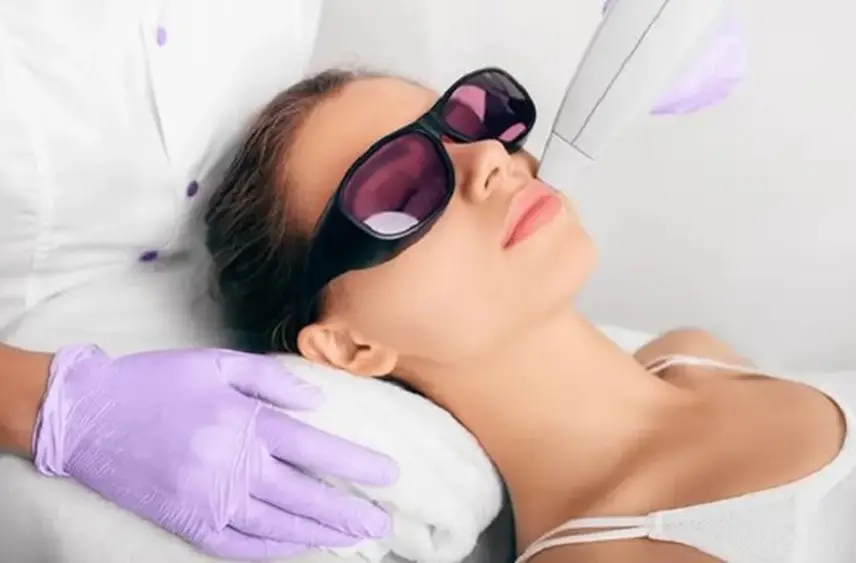 چگونگی انجام لیزر مو زائد