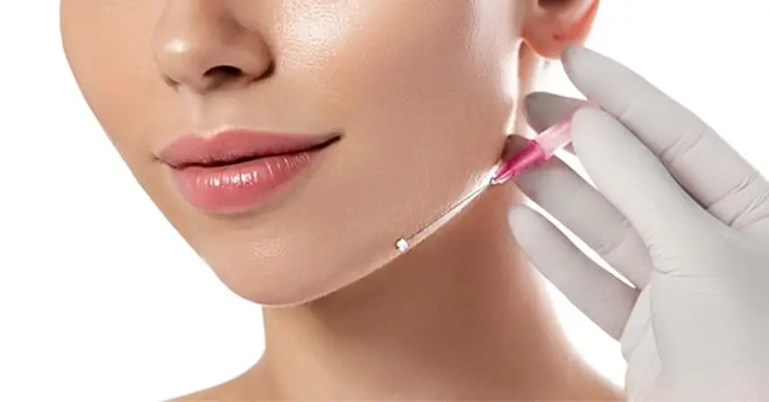 لیفت با نخ چیست؟