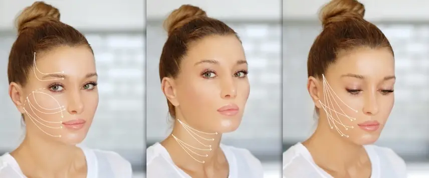 چه کسانی کاندیدای مناسبی برای لیفت با نخ هستند؟