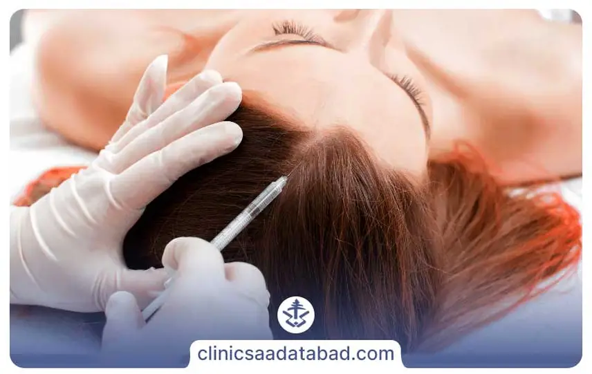 کاندیدای مناسب برای انجام مزوتراپی مو