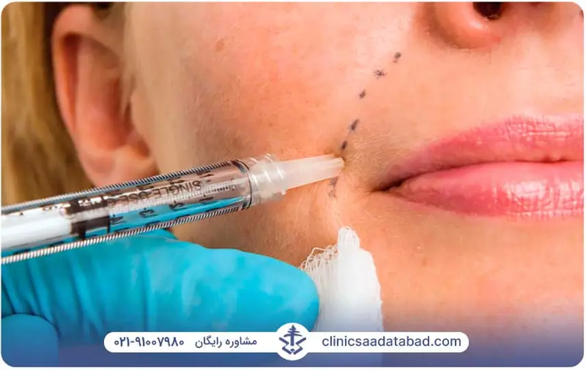 بوتاکس یا فیلر؟