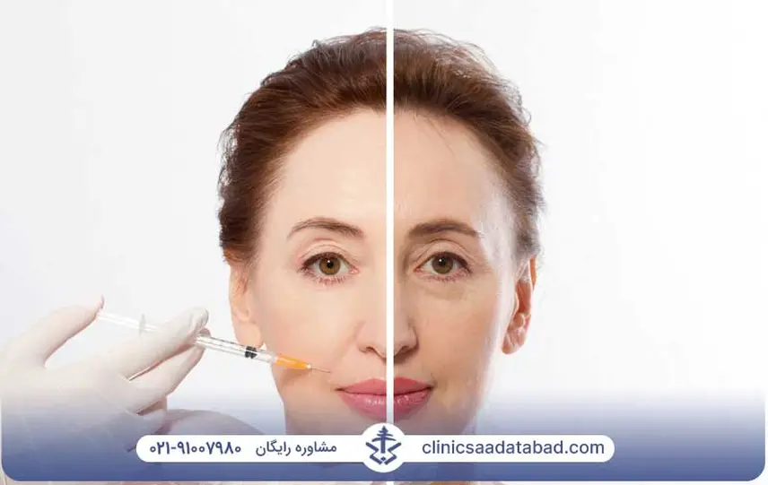 چه کسانی برای تزریق ژل مناسب هستند؟