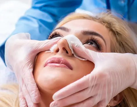 چسب زدن بینی